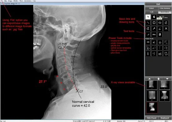 Chiropractic Orléans ON Chirosight Digital X-Ray