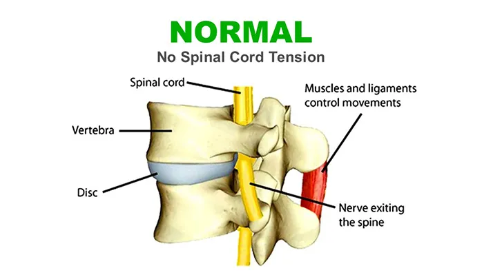 Chiropractic Orléans ON Normal Spine