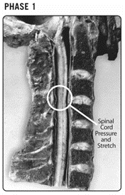 Chiropractic Orléans ON Phase One Spine