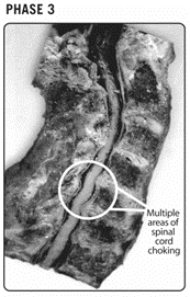 Chiropractic Orléans ON Phase Three Spine