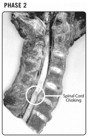 Chiropractic Orléans ON Phase Two Spine